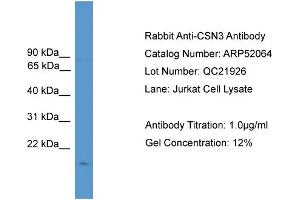 WB Suggested Anti-CSN3  Antibody Titration: 0. (CSN3 Antikörper  (N-Term))