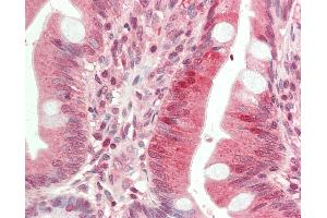 Anti-HDAC9 antibody IHC staining of human small intestine. (HDAC9 Antikörper  (Internal Region))