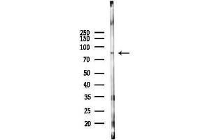 Western blot analysis of lysates from COLO205 cells(heat-shock,45 min treatment), using EP Antibody at 1/1000 dilution.