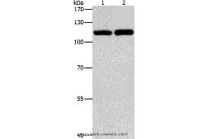 Western blot analysis of Raji and K562 cell, using TLR3 Polyclonal Antibody at dilution of 1:500 (TLR3 Antikörper)