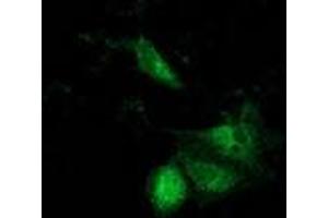 Anti-ACAT2 mouse monoclonal antibody (ABIN2453825) immunofluorescent staining of COS7 cells transiently transfected by pCMV6-ENTRY ACAT2 (RC201821). (ACAT2 Antikörper)