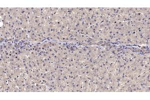 Detection of RELN in Human Liver Tissue using Monoclonal Antibody to Reelin (RELN) (Reelin Antikörper  (AA 26-190))