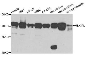 Western blot analysis of extracts of various cell lines, using MLXIPL antibody. (MLXIPL Antikörper  (AA 17-175))