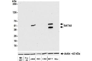 Western Blotting (WB) image for anti-GATA Binding Protein 3 (GATA3) (AA 150-200) antibody (ABIN7455153) (Rekombinanter GATA3 Antikörper  (AA 150-200))