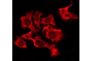 ABIN6276209 staining Hela by IF/ICC. (QRFPR Antikörper  (Internal Region))