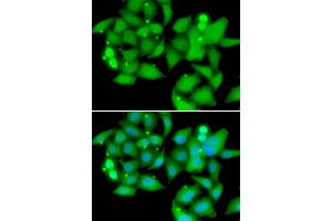 Immunofluorescence analysis of A549 cells using UBASH3B antibody (ABIN5974296). (UBASH3B Antikörper)