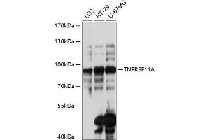 Western blot analysis of extracts of various cell lines, using TNFRSF11A antibody (ABIN6127589, ABIN6149310, ABIN6149312 and ABIN6217357) at 1:3000 dilution. (TNFRSF11A Antikörper  (AA 466-616))