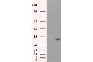 Western Blotting (WB) image for anti-Nitrilase 1 (NIT1) antibody (ABIN1499735)