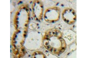 Immunohistochemistry (IHC) image for anti-Cytochrome P450, Family 27, Subfamily B, Polypeptide 1 (CYP27B1) (AA 258-504) antibody (ABIN7441061)