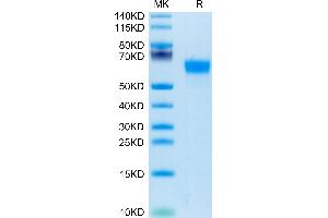 Human Factor H on Tris-Bis PAGE under reduced condition. (Complement Factor H Protein (CFH) (AA 860-1231) (His tag))