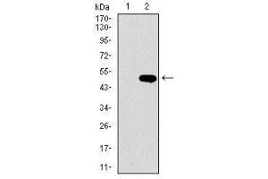 Image no. 2 for anti-LIM Domain Only 2 (Rhombotin-Like 1) (LMO2) antibody (ABIN1490594) (LMO2 Antikörper)