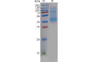 Human CLU Protein, His Tag on SDS-PAGE under reducing condition.