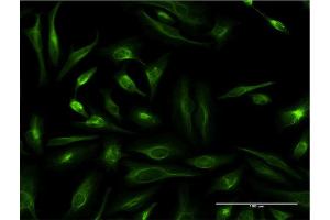 Immunofluorescence of monoclonal antibody to TAGLN on HeLa cell. (Transgelin Antikörper  (AA 1-201))
