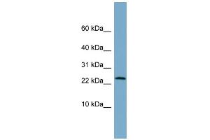 WB Suggested Anti-LRRC20 Antibody Titration: 0. (LRRC20 Antikörper  (Middle Region))