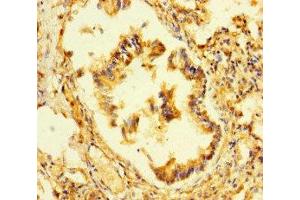 Immunohistochemistry of paraffin-embedded human lung tissue using ABIN7164777 at dilution of 1:100 (LEPREL1 Antikörper  (AA 301-528))