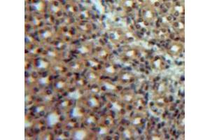 Used in DAB staining on fromalin fixed paraffin-embedded Kidney tissue (IL12B Antikörper  (AA 35-302))