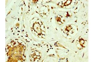Immunohistochemistry (IHC) image for anti-Superoxide Dismutase 2, Mitochondrial (SOD2) (AA 64-175) antibody (ABIN7170983)