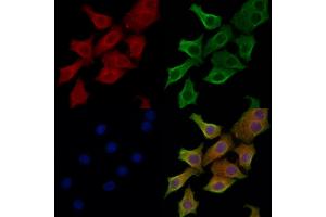 ABIN6262783 and ABIN6266573 staining HepG2 cells by IF/ICC.