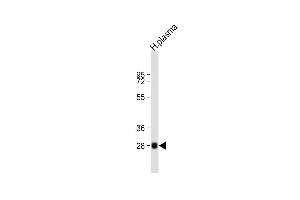 Anti-CFD Antibody (N-term) at 1:2000 dilution + human plasma lysate Lysates/proteins at 20 μg per lane.