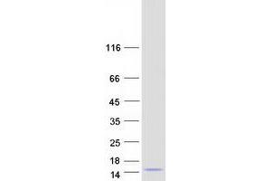 Western Blotting (WB) image for Chemokine (C-C Motif) Ligand 4-Like 1 (CCL4L1) protein (Myc-DYKDDDDK Tag) (ABIN2713964)