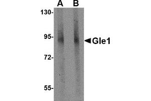 Western Blotting (WB) image for anti-GLE1 RNA Export Mediator (GLE1) (C-Term) antibody (ABIN1030413) (GLE1 Antikörper  (C-Term))