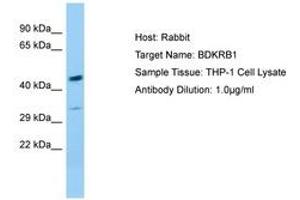 Image no. 1 for anti-Bradykinin Receptor B1 (BDKRB1) (AA 230-279) antibody (ABIN6749995) (BDKRB1 Antikörper  (AA 230-279))