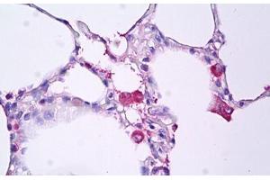 Anti-TNF Alpha antibody IHC staining of human lung, macrophages. (TNF alpha Antikörper)