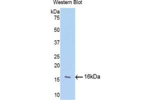Western blot analysis of the recombinant protein. (FGF13 Antikörper  (AA 108-227))