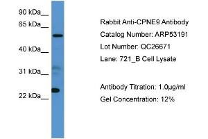 WB Suggested Anti-CPNE9  Antibody Titration: 0.