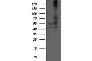 Image no. 1 for anti-Dihydrolipoamide Dehydrogenase (DLD) antibody (ABIN1497850) (DLD Antikörper)