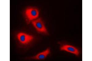 Immunofluorescent analysis of TRAF3 staining in HeLa cells. (TRAF3 Antikörper  (Center))