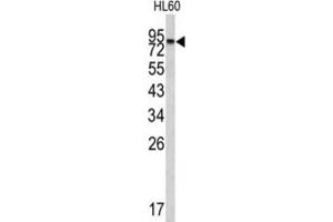 Western Blotting (WB) image for anti-Carboxypeptidase X (M14 Family), Member 2 (CPXM2) antibody (ABIN3002685)