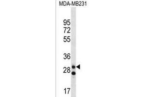 LRRC3C Antibody (C-term) (ABIN1536905 and ABIN2850344) western blot analysis in MDA-M cell line lysates (35 μg/lane). (LRRC3C Antikörper  (C-Term))
