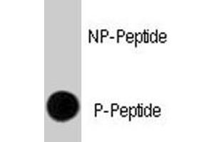 Dot blot analysis of ERBB2 (phospho Y1248) polyclonal antibody  on nitrocellulose membrane. (ErbB2/Her2 Antikörper  (pTyr1248))