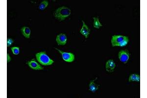 Immunofluorescent analysis of MCF-7 cells using ABIN7151390 at dilution of 1:100 and Alexa Fluor 488-congugated AffiniPure Goat Anti-Rabbit IgG(H+L) (ENPP6 Antikörper  (AA 31-330))