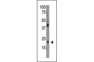 The anti-PD Antibody (C-term) (ABIN390190 and ABIN2840681) is used in Western blot to detect PD in HL60 lysate. (PDAP1 Antikörper  (C-Term))