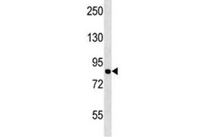 MCM7 antibody western blot analysis in Jurkat lysate. (MCM7 Antikörper  (AA 290-318))