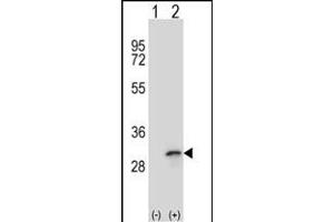 Western blot analysis of FHL1 (arrow) using rabbit polyclonal FHL1 Antibody (C-term) (ABIN390835 and ABIN2841061). (FHL1 Antikörper  (C-Term))