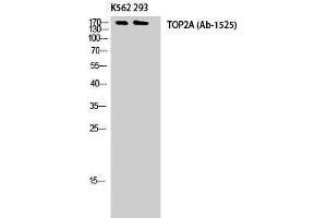 anti-Topo IIalpha (Tyr174) antibody