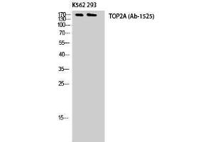 Western Blotting (WB) image for anti-Topo IIalpha (Tyr174) antibody (ABIN3177762) (Topo IIalpha (Tyr174) Antikörper)