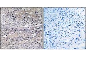 Immunohistochemistry analysis of paraffin-embedded human thyroid gland tissue, using IREB1 (Ab-711) Antibody. (Aconitase 1 Antikörper  (AA 681-730))