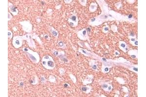 Detection of STX1A in Human Cerebrum Tissue using Polyclonal Antibody to Syntaxin 1A, Brain (STX1A) (STX1A Antikörper  (AA 1-255))