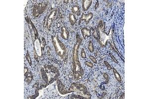 IHC analysis of SMAD2 using anti-SMAD2 antibody (ABIN7602542). (SMAD2 Antikörper  (AA 83-264))