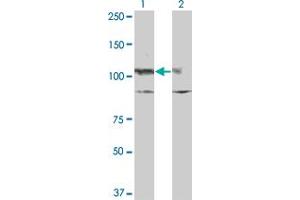 Western Blot analysis of KIT expression in transfected 293T cell line by KIT monoclonal antibody (M10), clone x1.
