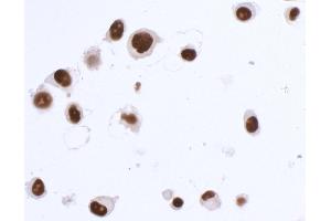Immunocytochemistry (ICC) image for anti-SRY (Sex Determining Region Y)-Box 10 (SOX10) (AA 416-466) antibody (ABIN7454037) (Rekombinanter SOX10 Antikörper  (AA 416-466))