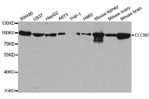 Western blot analysis of extracts of various cell lines, using CLCN5 antibody. (Chloride Channel 5 Antikörper  (AA 637-816))