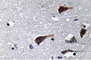 Immunohistochemistry analysis of Cathepsin B Antibody in Paraffin-Embedded Human brain tissue. (Cathepsin B Antikörper)