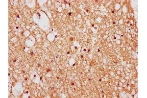 IHC image of ABIN7176211 diluted at 1:400 and staining in paraffin-embedded human brain tissue performed on a Leica BondTM system. (ZNF282 Antikörper  (AA 240-384))