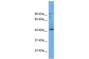 WB Suggested Anti-HOXB3 Antibody Titration: 0. (HOXB3 Antikörper  (Middle Region))