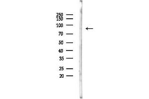 anti-SUMO1/sentrin Specific Peptidase 5 (SENP5) antibody